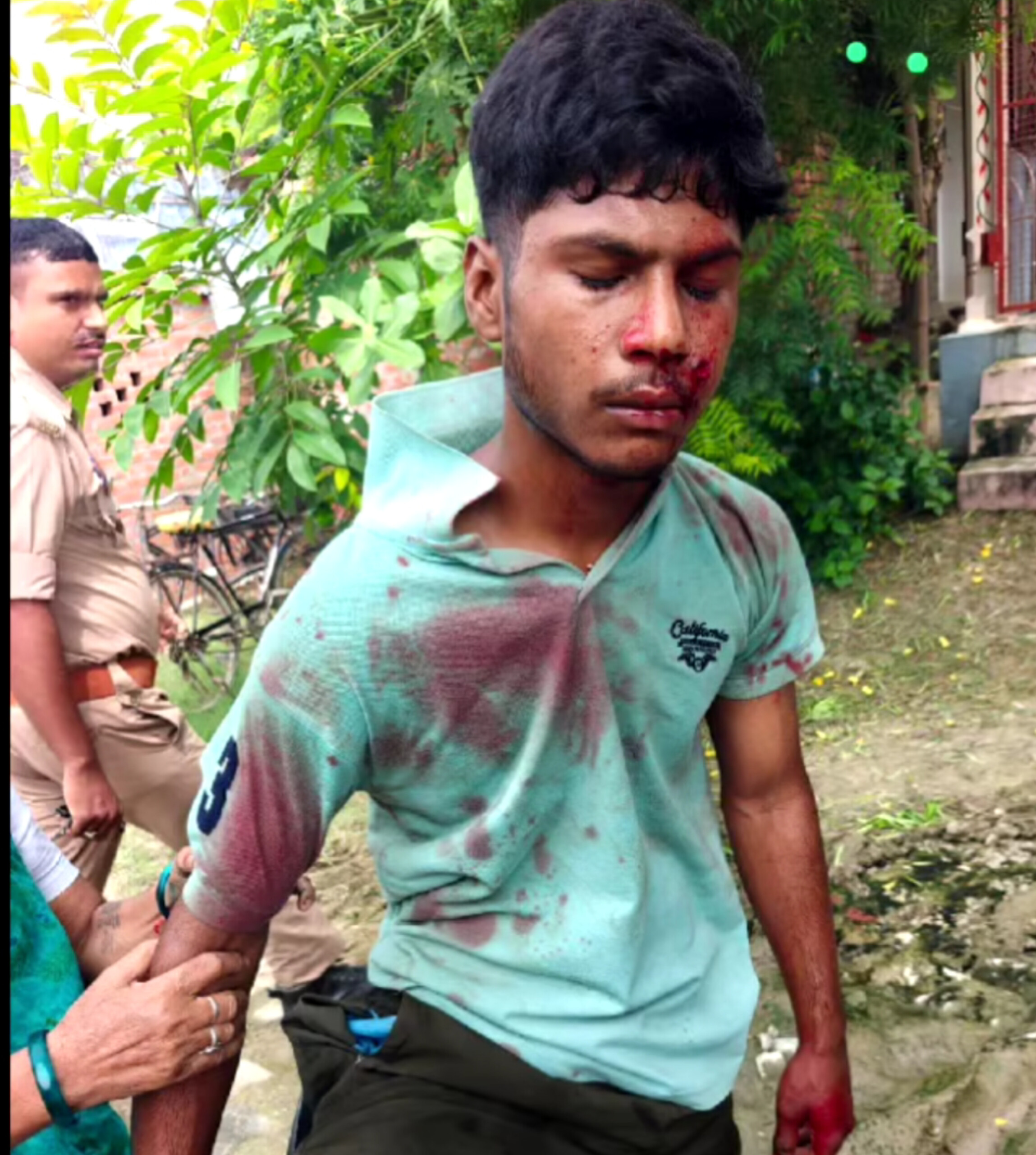 रील का जुनून पड़ा भारी: वाराणसी के फूलपुर में रील बनाते समय असलहे से चली गोली, 17 वर्षीय किशोर गंभीर; 2 हिरासत में